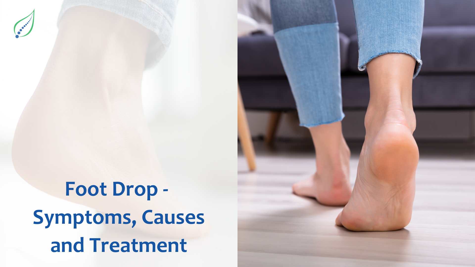 Foot Drop - Symptoms, Causes and Treatment